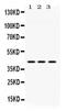 Acetyl-CoA Acyltransferase 2 antibody, PA5-78709, Invitrogen Antibodies, Western Blot image 