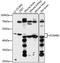 Potassium Voltage-Gated Channel Subfamily A Member Regulatory Beta Subunit 1 antibody, LS-C750304, Lifespan Biosciences, Western Blot image 