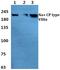Sodium Voltage-Gated Channel Alpha Subunit 8 antibody, PA5-37276, Invitrogen Antibodies, Western Blot image 