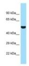 Succinate--hydroxymethylglutarate CoA-transferase antibody, NBP1-98273, Novus Biologicals, Western Blot image 