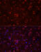 NMDAR2B antibody, 18-922, ProSci, Immunofluorescence image 