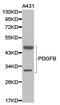 Platelet Derived Growth Factor Subunit B antibody, TA326987, Origene, Western Blot image 
