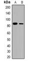 Catenin Beta 1 antibody, orb382589, Biorbyt, Western Blot image 