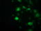 Suppressor Of Cytokine Signaling 3 antibody, TA503055, Origene, Immunofluorescence image 