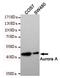 Aurora Kinase A antibody, STJ99106, St John