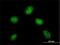 DPY30 Domain Containing 1 antibody, H00143241-M01, Novus Biologicals, Immunofluorescence image 