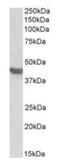 Solute Carrier Family 2 Member 4 antibody, GTX88031, GeneTex, Western Blot image 
