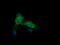 Cancer/Testis Antigen 1B antibody, LS-C174397, Lifespan Biosciences, Immunofluorescence image 