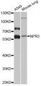 Natriuretic Peptide Receptor 3 antibody, A8138, ABclonal Technology, Western Blot image 