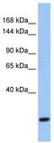 F-Box And WD Repeat Domain Containing 10 antibody, TA340205, Origene, Western Blot image 