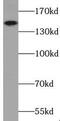 Tripartite Motif Containing 33 antibody, FNab08981, FineTest, Western Blot image 