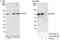 KOC antibody, A303-425A, Bethyl Labs, Immunoprecipitation image 