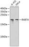 RAB7A, Member RAS Oncogene Family antibody, 14-370, ProSci, Western Blot image 