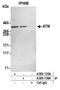 Serine-protein kinase ATM antibody, A300-136A, Bethyl Labs, Immunoprecipitation image 