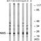 Neuromedin S antibody, PA5-39297, Invitrogen Antibodies, Western Blot image 