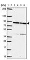 Von Willebrand Factor A Domain Containing 5B2 antibody, NBP2-38918, Novus Biologicals, Western Blot image 