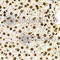 Histone Cluster 3 H3 antibody, A2362, ABclonal Technology, Immunohistochemistry paraffin image 