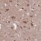 HYLS1 Centriolar And Ciliogenesis Associated antibody, PA5-59480, Invitrogen Antibodies, Immunohistochemistry frozen image 