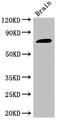 GRB2-associated-binding protein 2 antibody, LS-C678016, Lifespan Biosciences, Western Blot image 