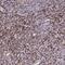 Zinc Finger Protein 559 antibody, HPA059632, Atlas Antibodies, Immunohistochemistry paraffin image 