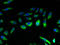 CCR-4 antibody, A62218-100, Epigentek, Immunofluorescence image 
