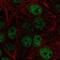 Zinc fingers and homeoboxes protein 1 antibody, NBP2-55880, Novus Biologicals, Immunocytochemistry image 