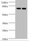 ATP Synthase F1 Subunit Alpha antibody, A50061-100, Epigentek, Western Blot image 