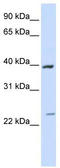 Acyl-CoA Dehydrogenase Long Chain antibody, TA334668, Origene, Western Blot image 