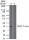 Histone Deacetylase 7 antibody, TA336888, Origene, Western Blot image 
