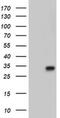 Peroxisomal trans-2-enoyl-CoA reductase antibody, MA5-25261, Invitrogen Antibodies, Western Blot image 