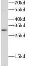 CD354 antibody, FNab09969, FineTest, Western Blot image 