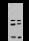 Nudix Hydrolase 11 antibody, 203807-T34, Sino Biological, Western Blot image 