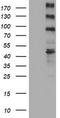 ALK Receptor Tyrosine Kinase antibody, TA801141, Origene, Western Blot image 