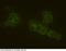 Htk antibody, 10235-MM04-F, Sino Biological, Immunocytochemistry image 
