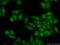 GTP Binding Protein 4 antibody, 13897-1-AP, Proteintech Group, Immunofluorescence image 