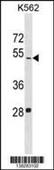 Lactate Dehydrogenase A Like 6B antibody, 59-931, ProSci, Western Blot image 