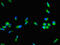 Coagulation Factor VIII antibody, A62534-100, Epigentek, Immunofluorescence image 