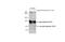 Angiotensin I Converting Enzyme 2 antibody, GTX101395, GeneTex, Western Blot image 