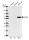 Methionyl Aminopeptidase 2 antibody, HPA019095, Atlas Antibodies, Western Blot image 