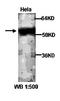Angiopoietin Like 6 antibody, orb77079, Biorbyt, Western Blot image 