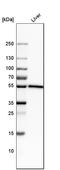 Nicotinate Phosphoribosyltransferase antibody, HPA023739, Atlas Antibodies, Western Blot image 