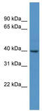 Forkhead Box S1 antibody, TA329404, Origene, Western Blot image 