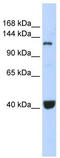 Piwi-like protein 1 antibody, TA346012, Origene, Western Blot image 