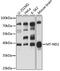 NADH-ubiquinone oxidoreductase chain 2 antibody, 18-175, ProSci, Western Blot image 