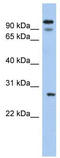 Voltage Dependent Anion Channel 3 antibody, TA338557, Origene, Western Blot image 