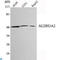 Aldh3 antibody, LS-C812878, Lifespan Biosciences, Western Blot image 