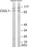 Cyclin Dependent Kinase 11B antibody, EKC1689, Boster Biological Technology, Western Blot image 