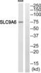 Solute Carrier Family 9 Member A6 antibody, abx014901, Abbexa, Western Blot image 