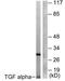 Transforming Growth Factor Alpha antibody, TA314615, Origene, Western Blot image 