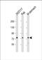 Phospholipase A2 Group IVF antibody, PA5-72302, Invitrogen Antibodies, Western Blot image 